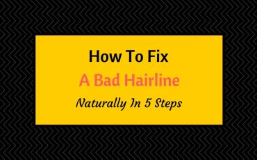 how to fix a bad hairline naturally