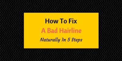how to fix a bad hairline naturally