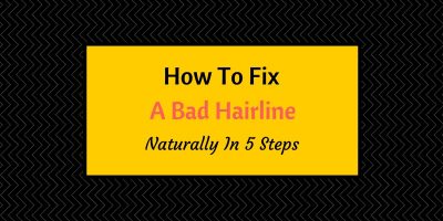 how to fix a bad hairline naturally