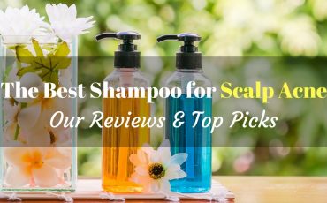 best shampoo for scalp acne