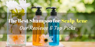 best shampoo for scalp acne