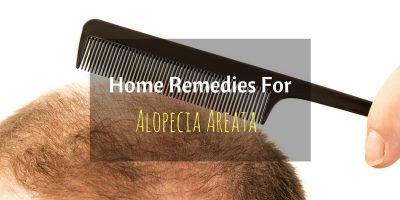 Home Remedies For Alopecia Areata