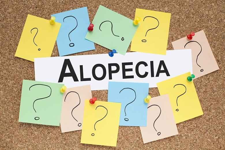 home remedies for alopecia areata