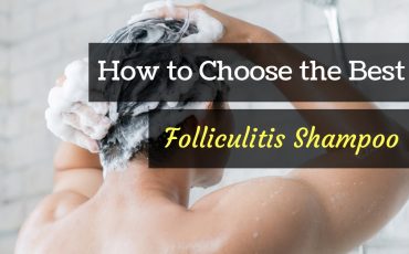 best folliculitis shampoo