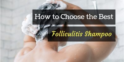 best folliculitis shampoo